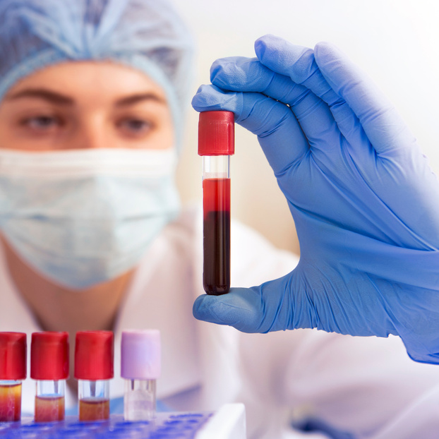 Woman lab worker holding test tube doing blood analysis