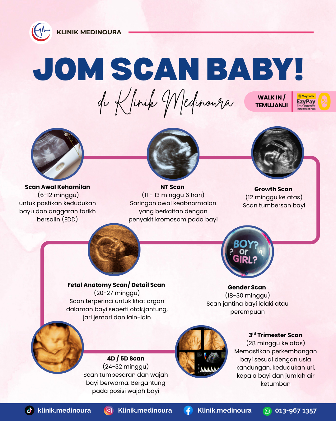 Klinik Medinoura Nilai Putrajaya scan baby