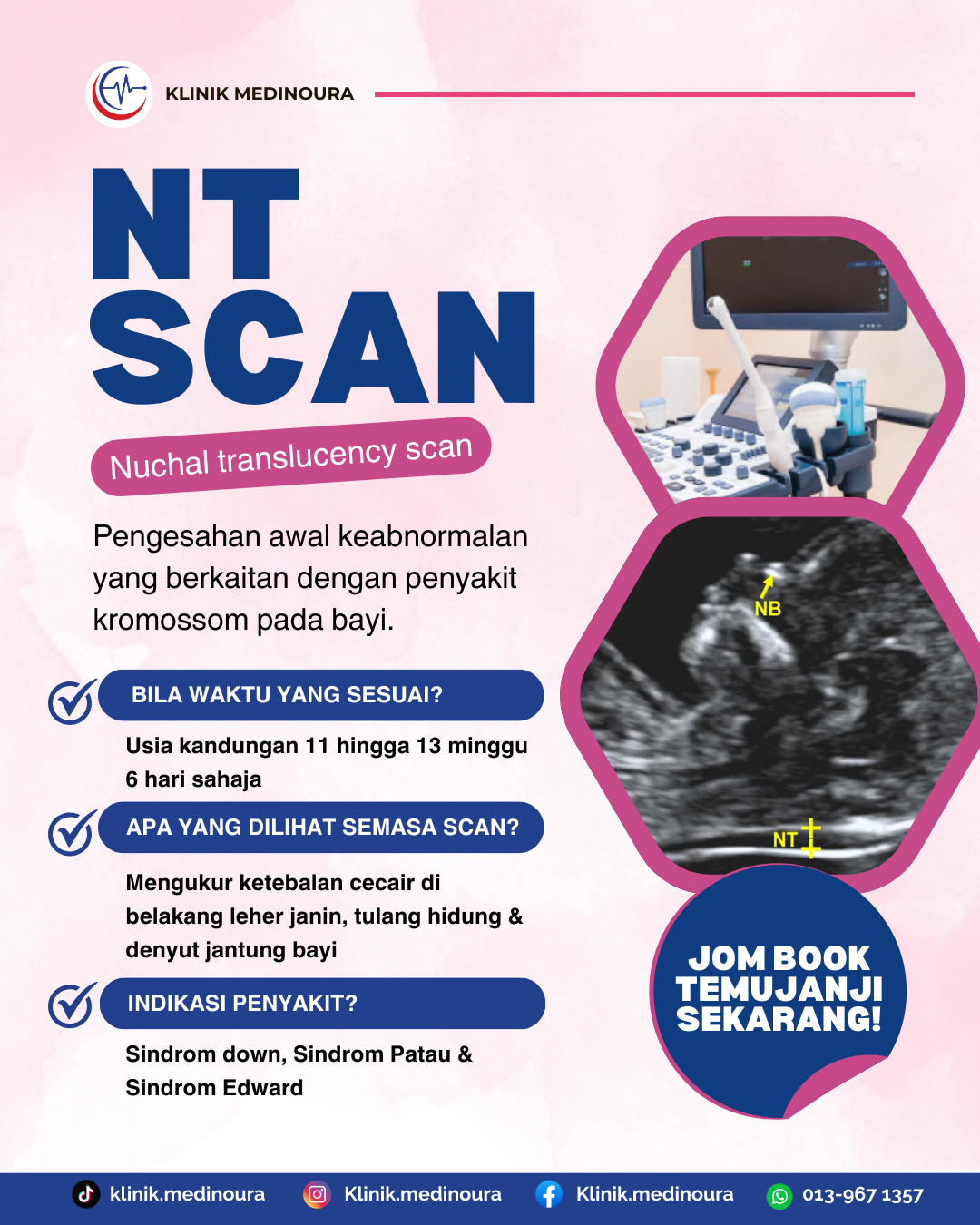 Klinik Medinoura Nilai Putrajaya nt scan