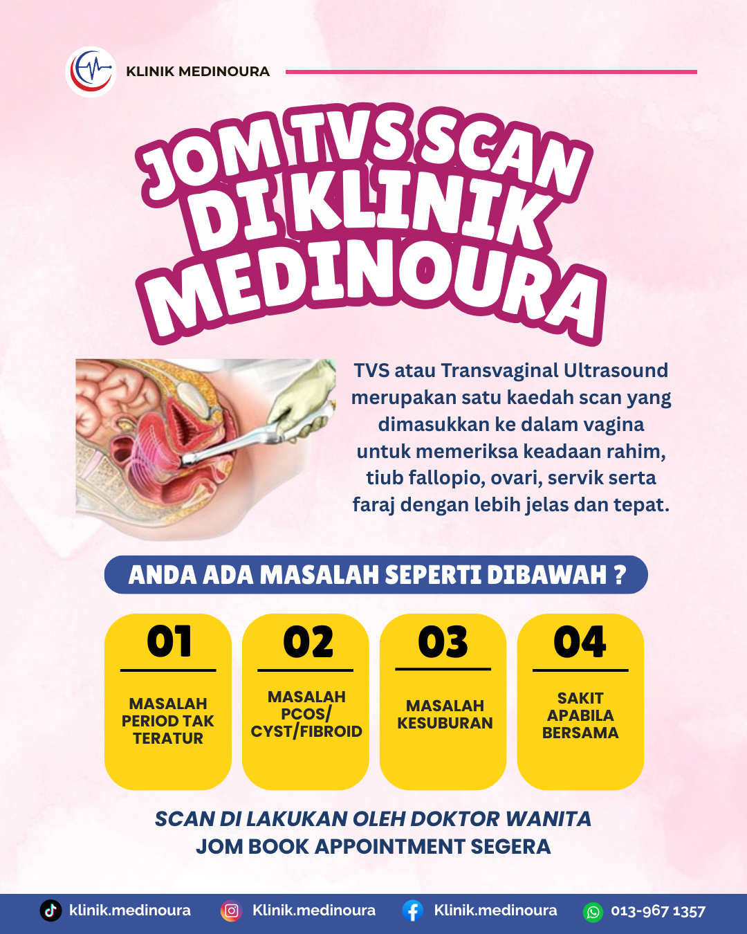 Scan Transvagina (TVS) & Saringan Masalah Haid